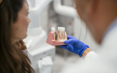 Implantes dentales: una solución permanente para la pérdida dental