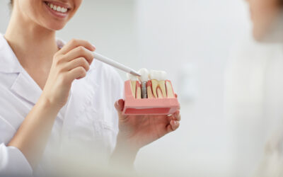 Implantes dentales: ¿Qué cuidados especiales requieren?