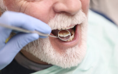 ¿Qué son las bolsas periodontales y cómo se tratan?
